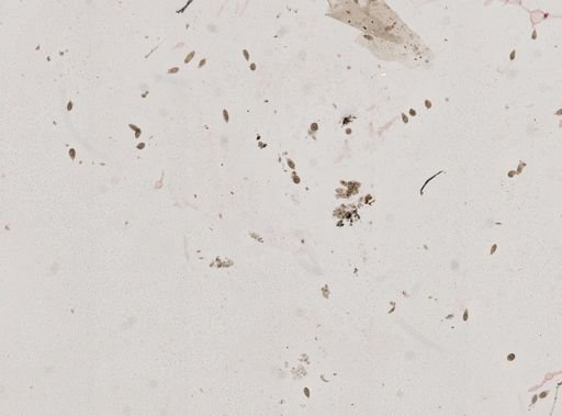 Euglena