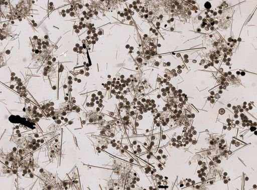 Ceratoporella nicholsoni