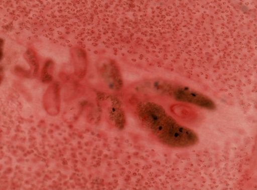 Diphyllobothrium latum