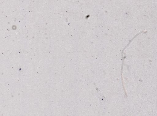 Plasmodium ovale