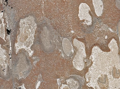 Taenia crassicollis