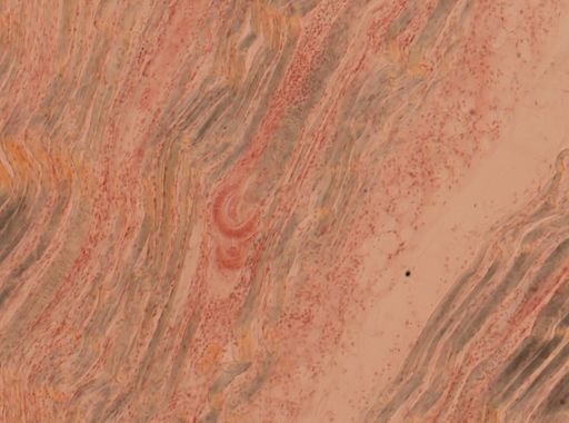 Trichinella spiralis