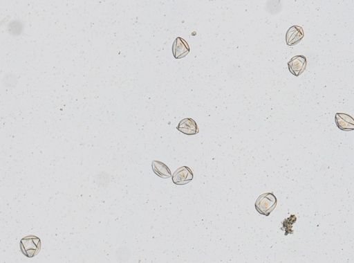 Hymenolepis diminuta