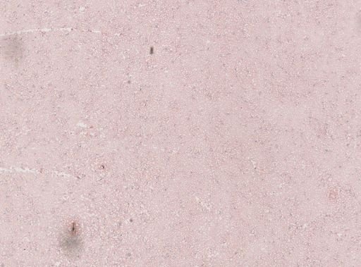 Plasmodium vivax