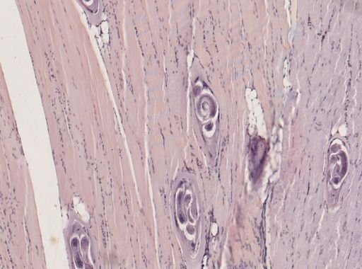 Trichinella spiralis
