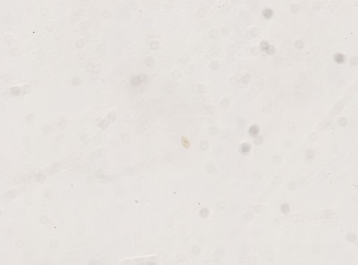 Paramecium trichium