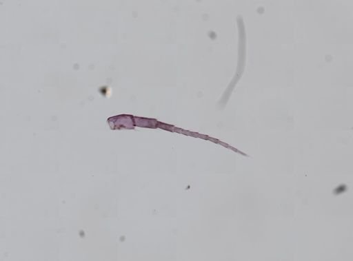 Hyalella cf. azteca