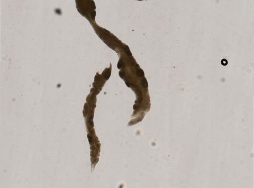 Nematoda