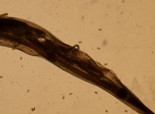 Enterobius vermicularis