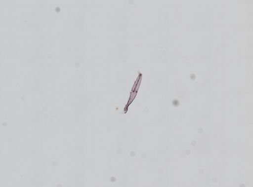 Hyalella cf. azteca