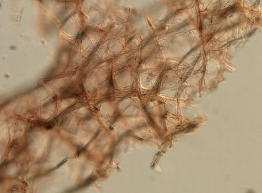 cf. Dasychalina