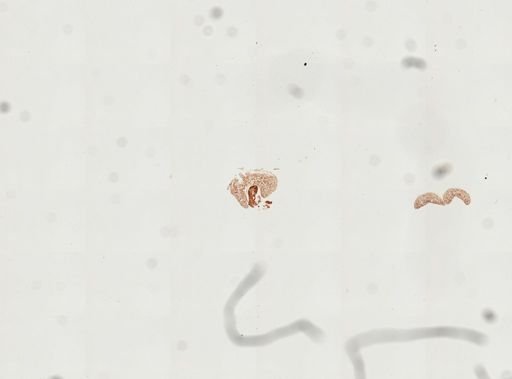 Latocestus whartoni