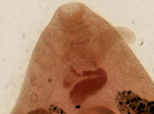 Fasciola hepatica
