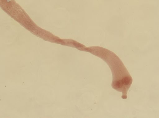 Dipylidium caninum