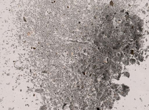 Entamoeba histolytica