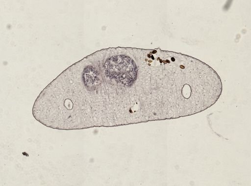 Dicrocoelium dendriticum
