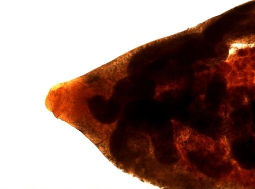 Haematoloechus longiplexus
