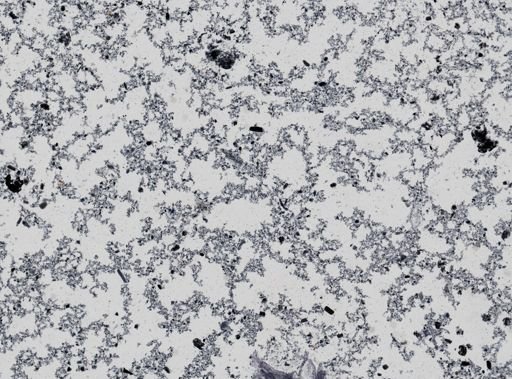 Giardia lamblia