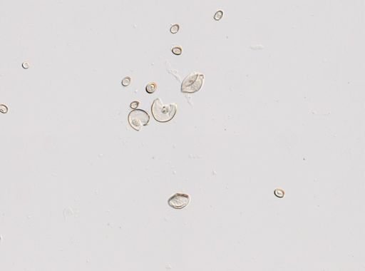 Cestoda