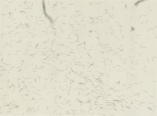 Haliclona oculata