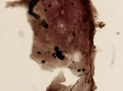 Cliona sp.