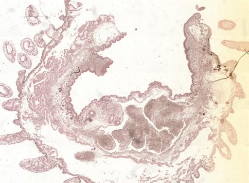 Thysanozoon brocchii
