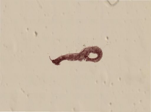 Stylaria lacustris