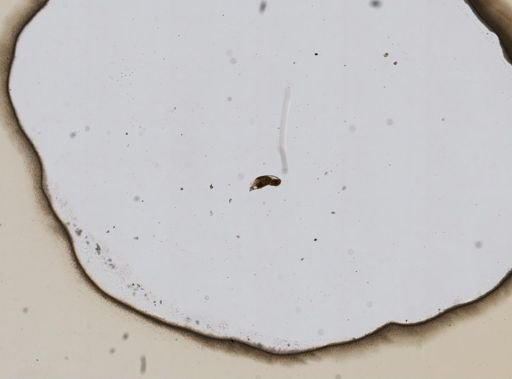 Notommata thopica
