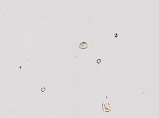 Cestoda