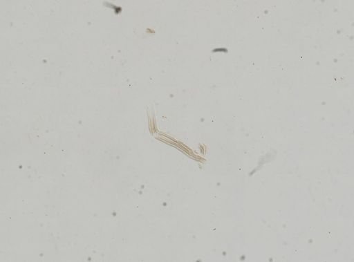 Bythinella viridis