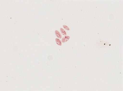 Paramecium calkinsi