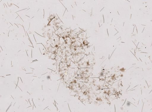 Ceratoporella nicholsoni