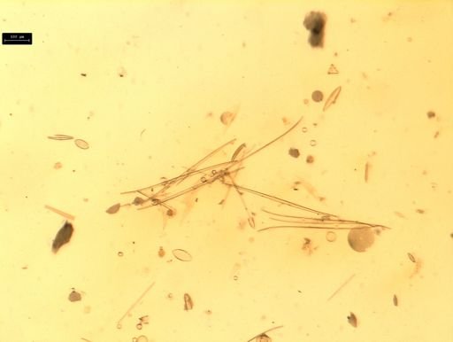 Diatoms