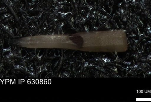 Echinoidea?