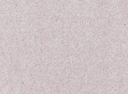 Trypanosoma