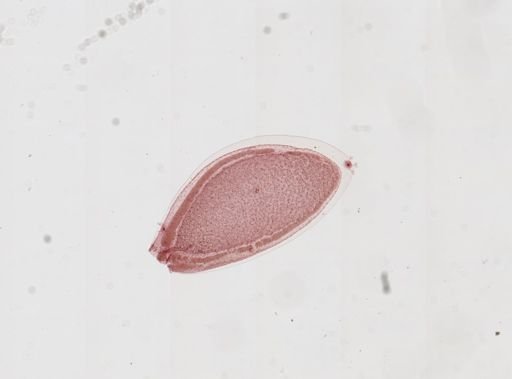 Dendrocometes paradoxus