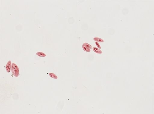 Paramecium calkinsi