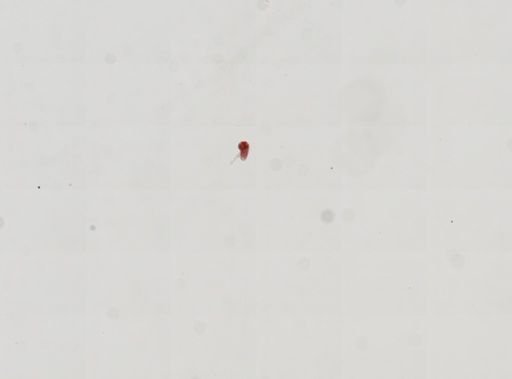 Trematoda