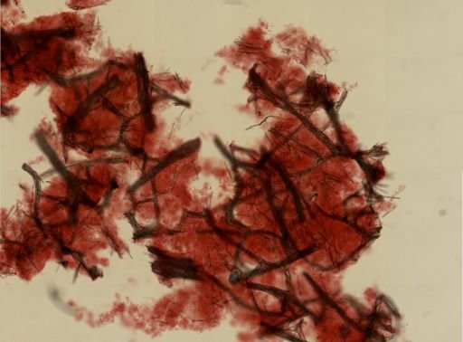 Isodictya deichmannae