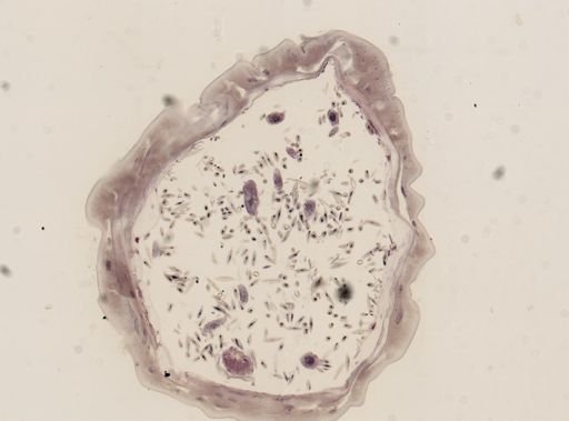 Echinorhynchus haeruca