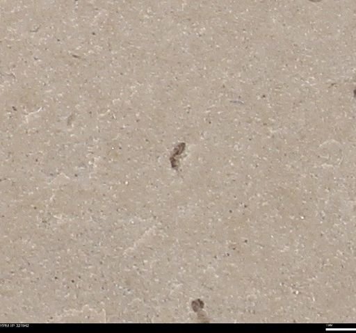 undet. Insecta