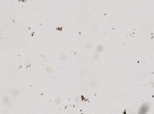 Toxocara cati