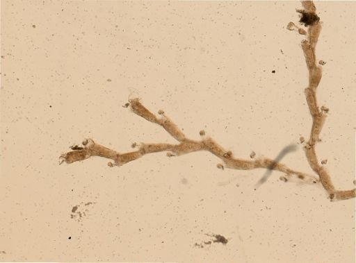 Kinetoskias uniserialis
