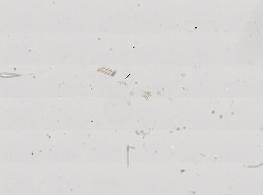 Lyogyrus pupoidea