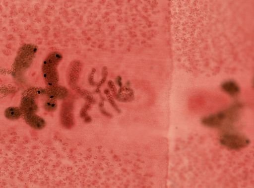 Diphyllobothrium latum