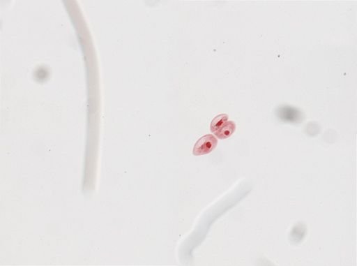 Paramecium calkinsi