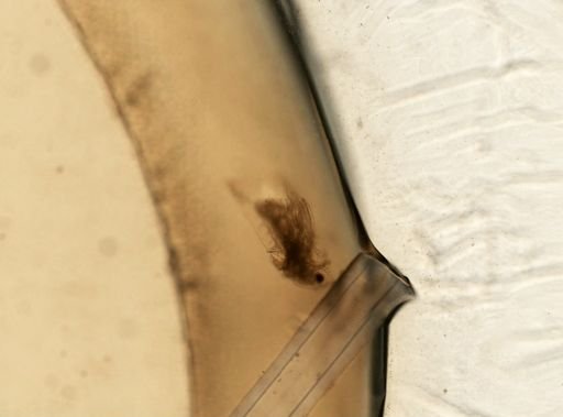 Daphnia pulex