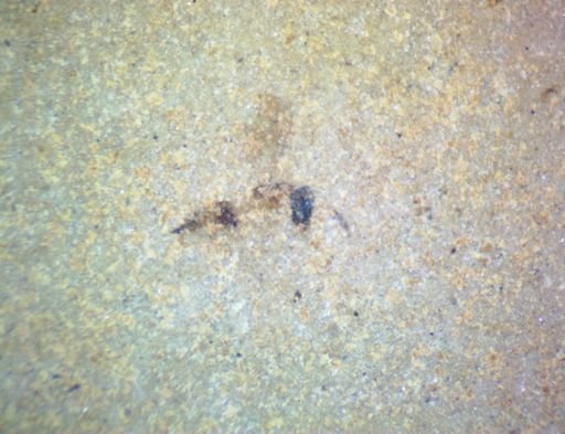 undet. Hexapoda