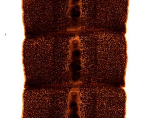 Diphyllobothrium erinacei
