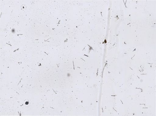 Astrosclera
